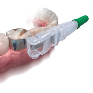 Zt Dental Easy Matrix Green - Image 2